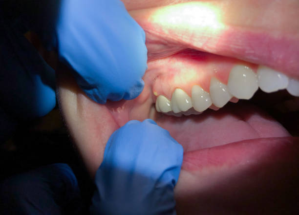 Professional Emergency Dental Service in PA